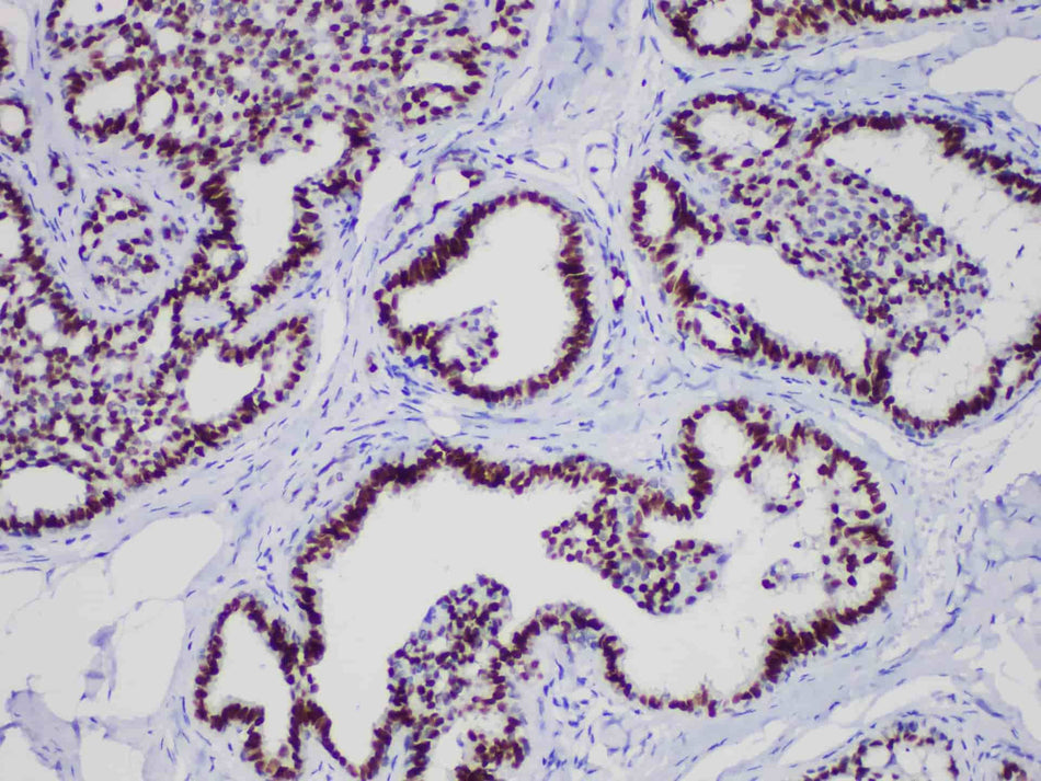 GATA3 Monoclonal Antibody Stored at -20°C