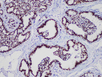 GATA3 Monoclonal Antibody Stored at -20°C