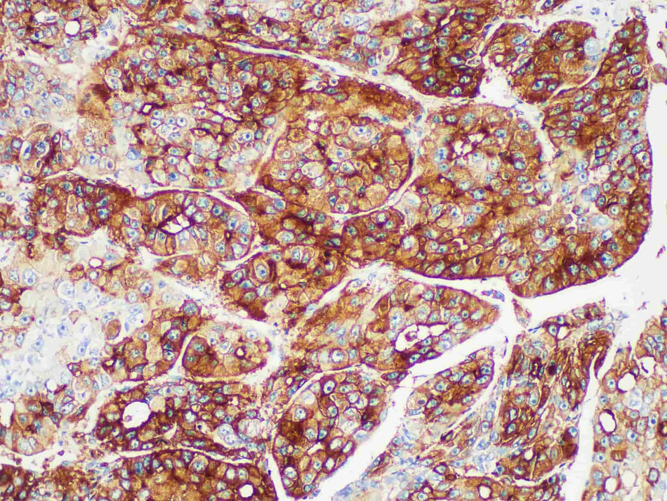 Glypican-3 Monoclonal Antibody Stored at -20°C
