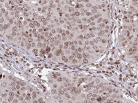 HPV16 Monoclonal Antibody