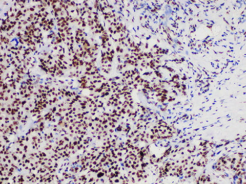 INI-1 Monoclonal Antibody Stored at -20°C