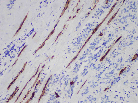 Myoglobin Monoclonal Antibody Stored at -20°C