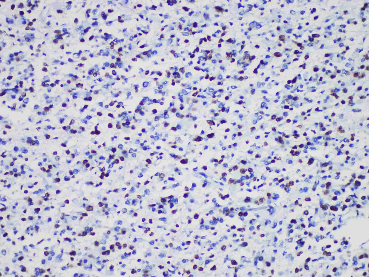 Olig2 Monoclonal Antibody Stored at -20°C