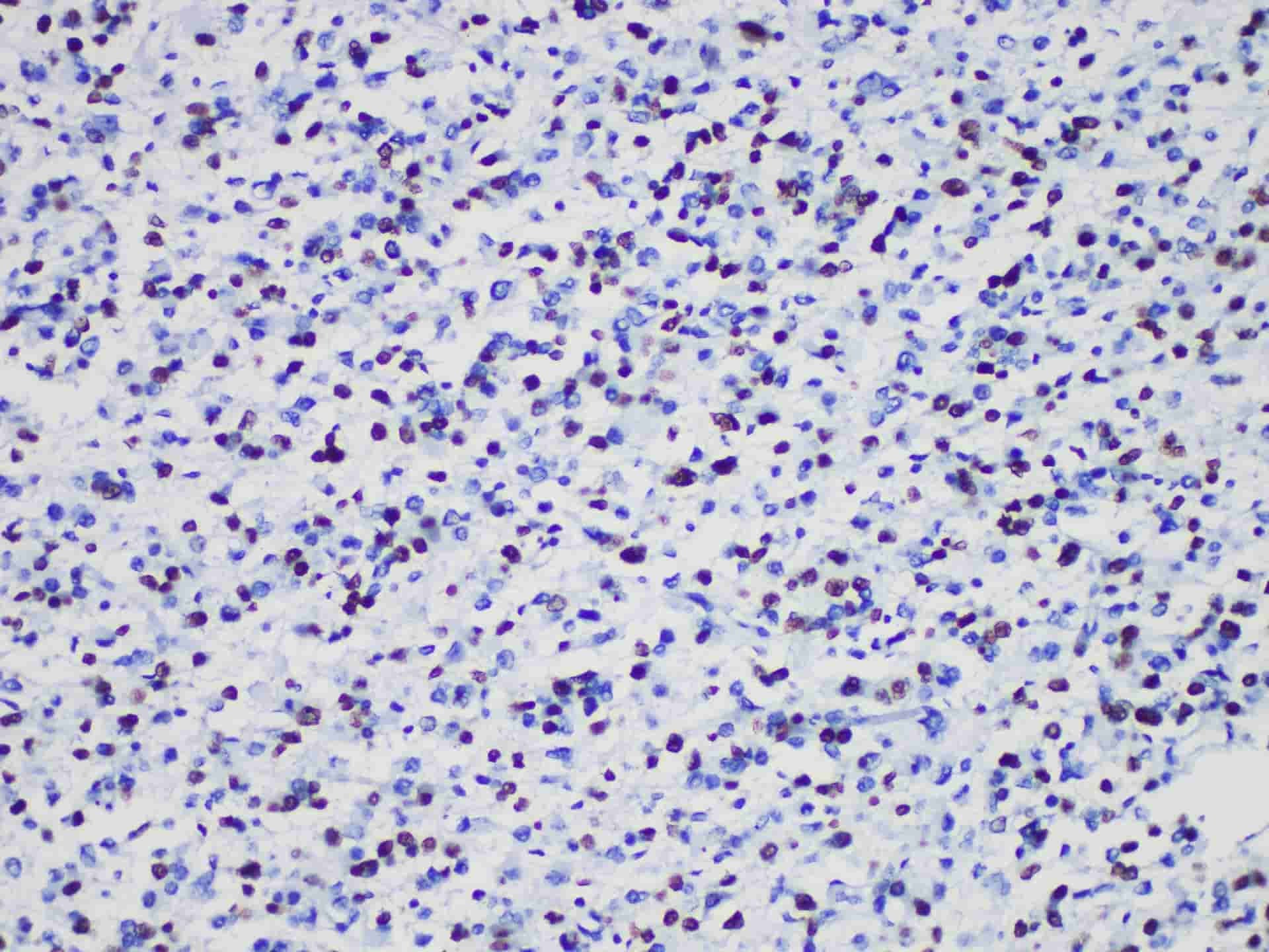 Olig2 Monoclonal Antibody Stored at -20°C