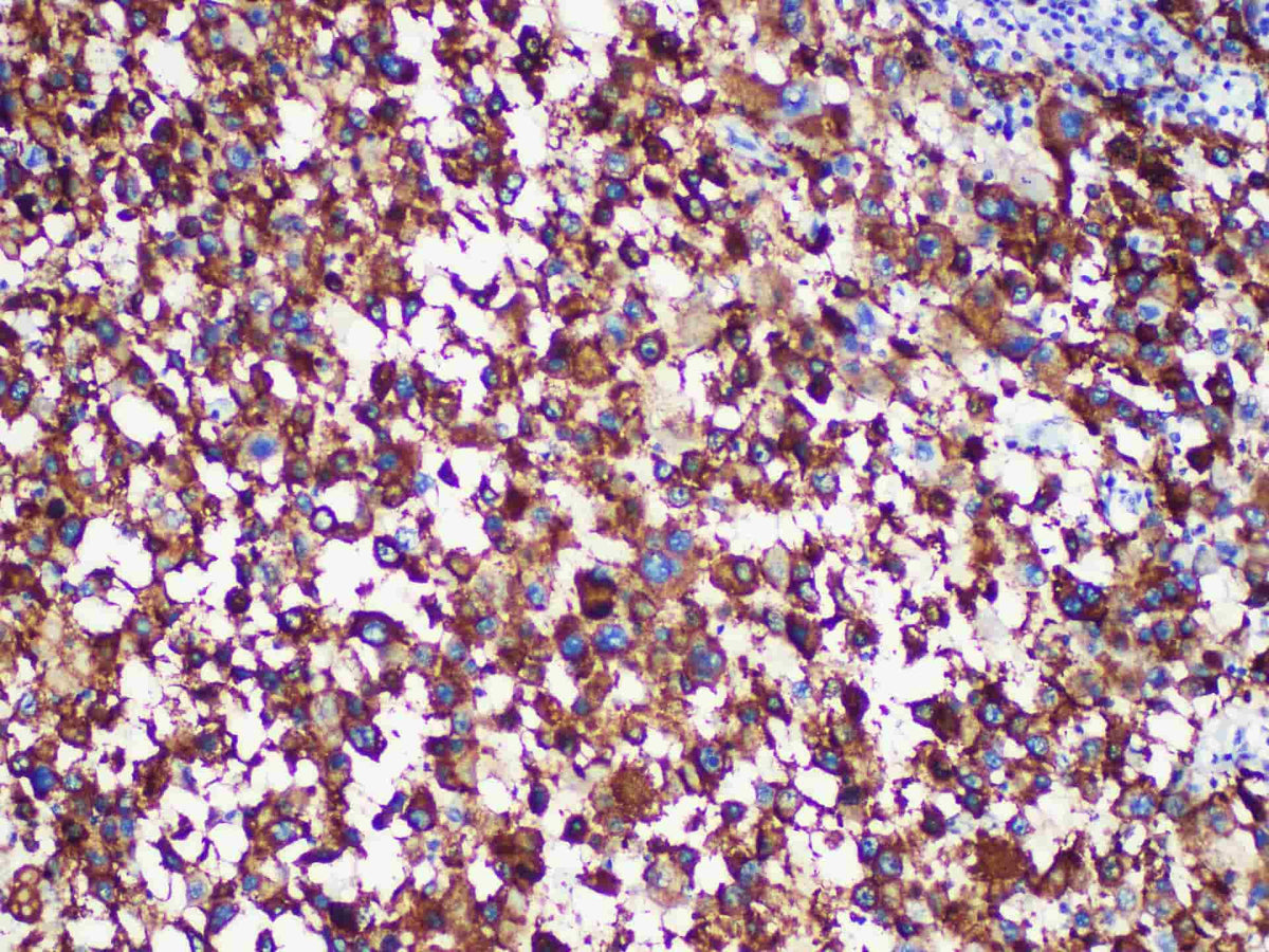 HMB-45 Monoclonal Antibody Stored at -20°C