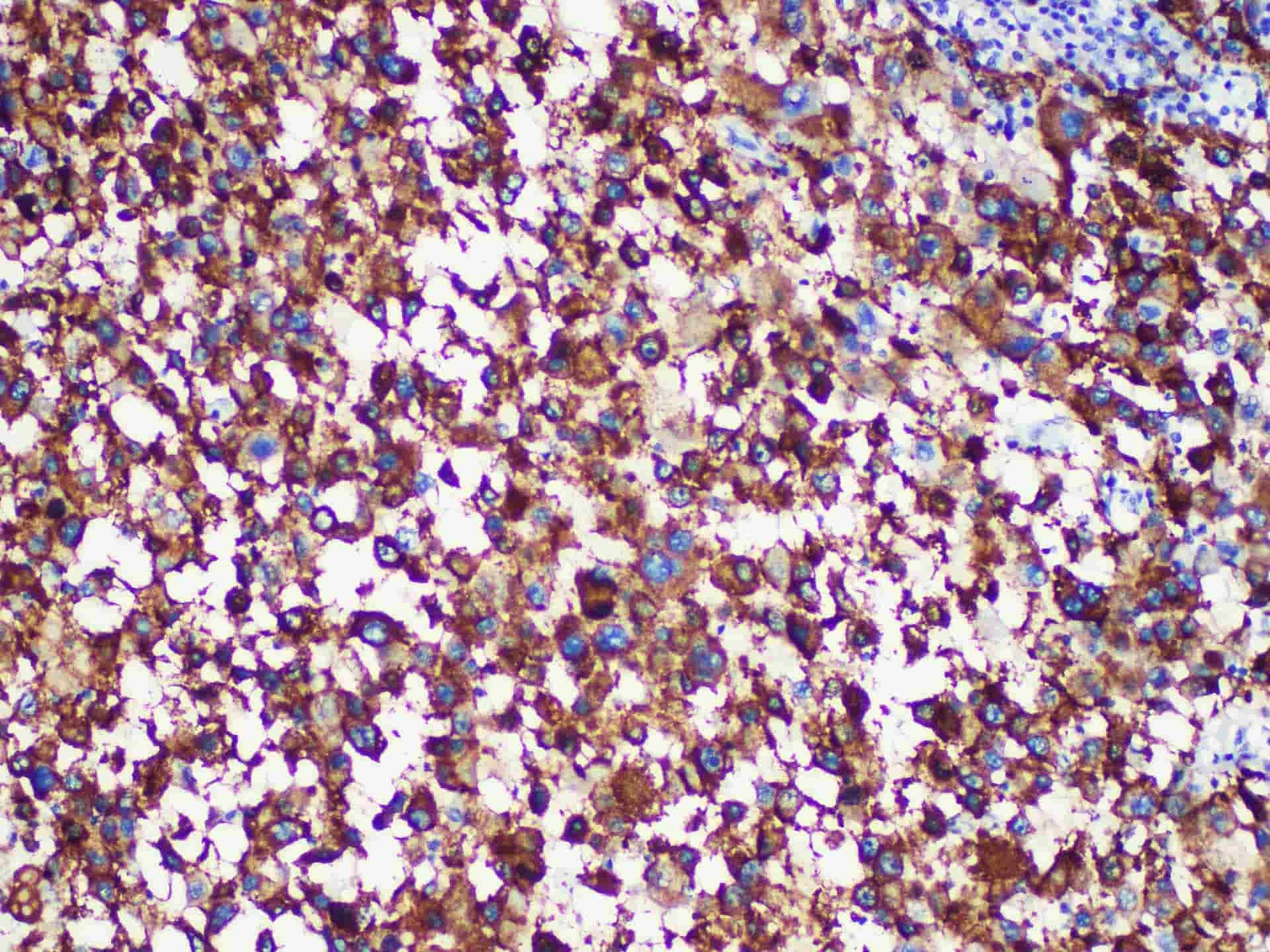 HMB-45 Monoclonal Antibody Stored at -20°C