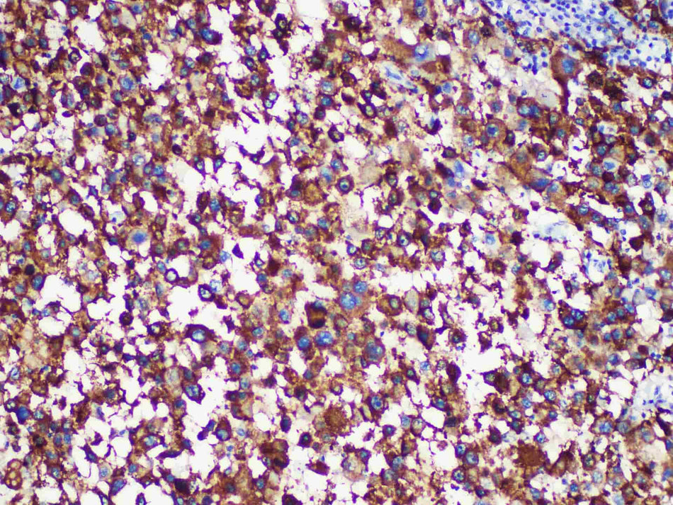 HMB-45 Monoclonal Antibody Stored at -20°C