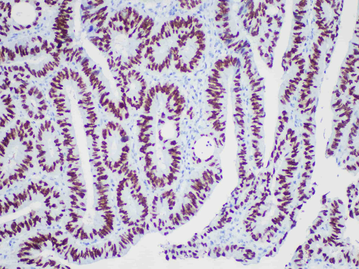 SATB2 Monoclonal Antibody Stored at -20°C