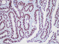 SATB2 Monoclonal Antibody Stored at -20°C