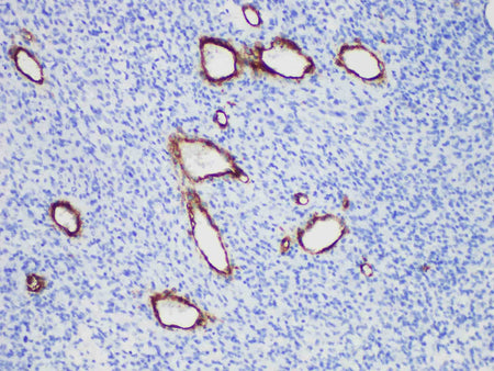 CD146 Monoclonal Antibody Stored at -20°C