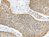 NFS1 Polyclonal Antibody Reactivity Human