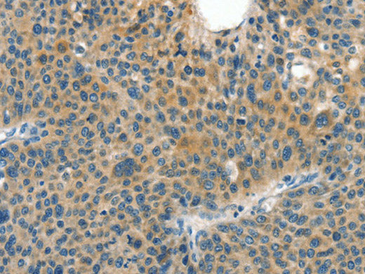 CRLF2 Polyclonal Antibody Store at -20°C