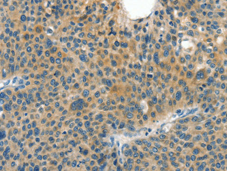 CRLF2 Polyclonal Antibody Store at -20°C