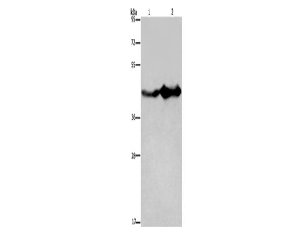 GLUL Polyclonal Antibody Store at -20°C