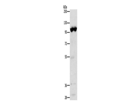 TRPM5 Polyclonal Antibody Store at -20°C