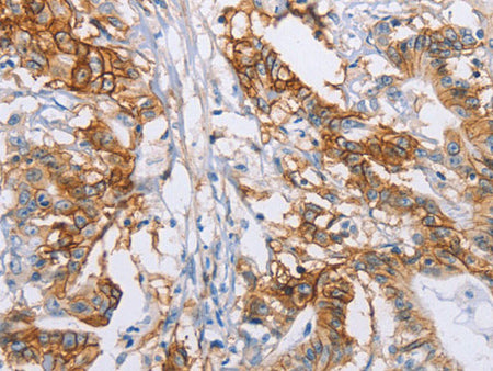 CA9 Polyclonal Antibody Store at -20°C