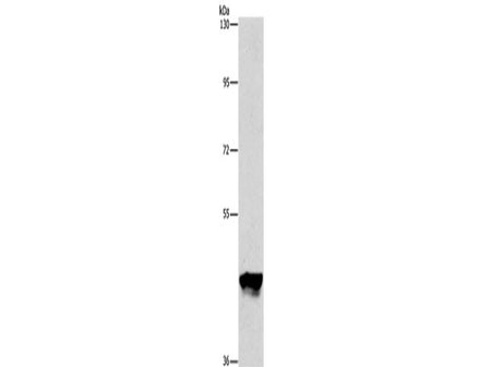 PIP4K2A Polyclonal Antibody Store at -20°C