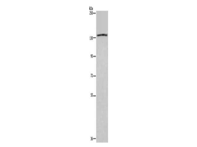 ITGAE Polyclonal Antibody Store at -20°C