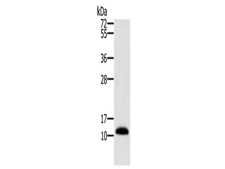 MSMB Polyclonal Antibody Store at -20°C