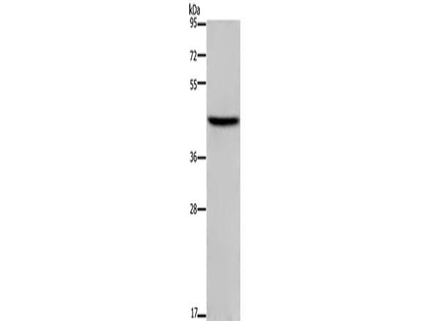 TFDP1 Polyclonal Antibody Store at -20°C
