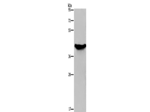GALK1 Polyclonal Antibody