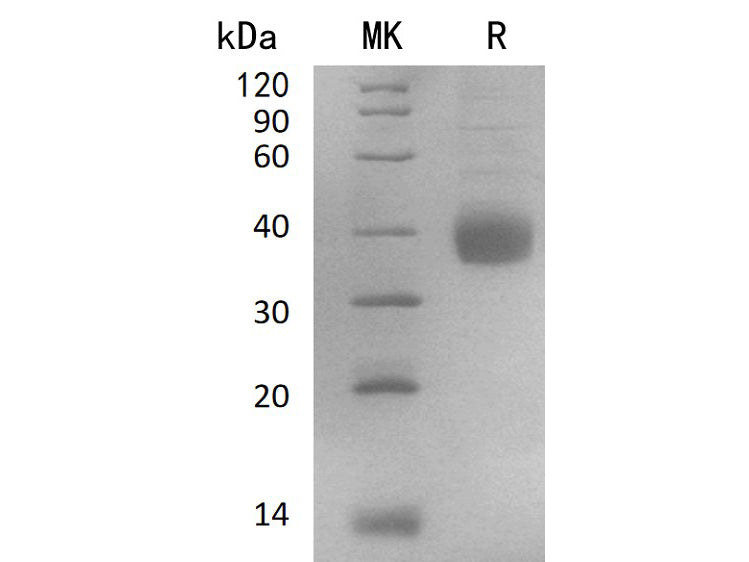 Recombinant Human NACHRA5/CHRNA5 Protein (His Tag)