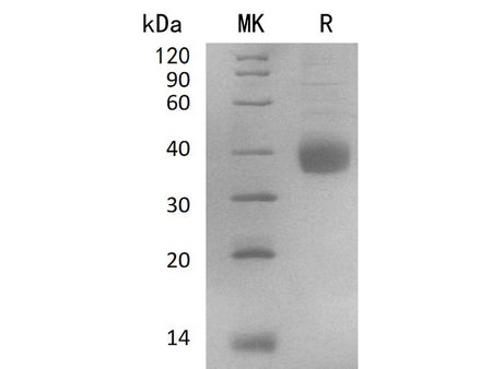 Recombinant Human NACHRA5/CHRNA5 Protein (His Tag)