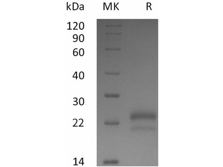 Recombinant Human VEGF165/VEGFA Protein (Active)