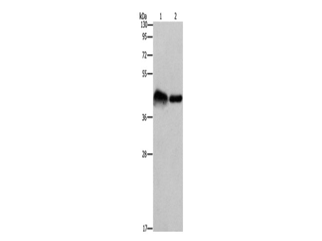 CRELD1 Polyclonal Antibody Store at -20°C