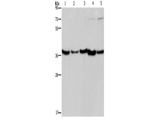 DNAJB4 Polyclonal Antibody Store at -20°C