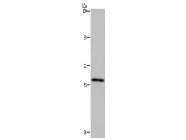 FTO Polyclonal Antibody Store at -20°C