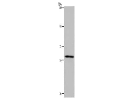 FTO Polyclonal Antibody Store at -20°C