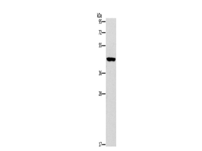 B3GAT1 Polyclonal Antibody Store at -20°C