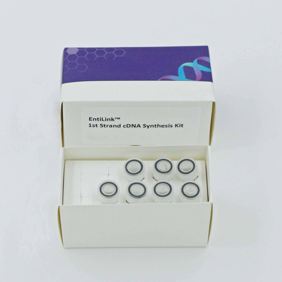 MSE PRO EntiLink 1st Strand cDNA Synthesis Kit (+gDNA Eraser)