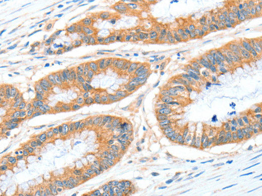 ALDH1A2 Polyclonal Antibody Store at -20°C