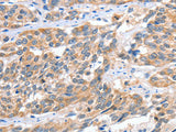 CGB Polyclonal Antibody Store at -20°C