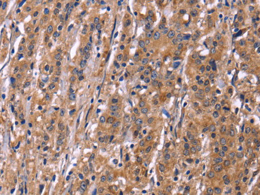 SEPT7 Polyclonal Antibody Store at -20°C