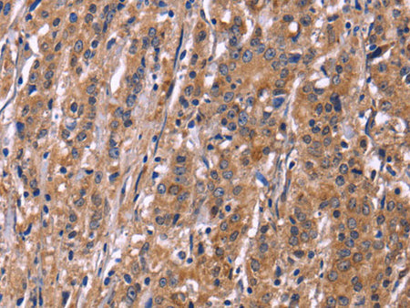 SEPT7 Polyclonal Antibody Store at -20°C