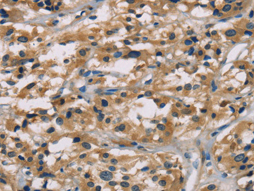 HCG Polyclonal Antibody Store at -20°C