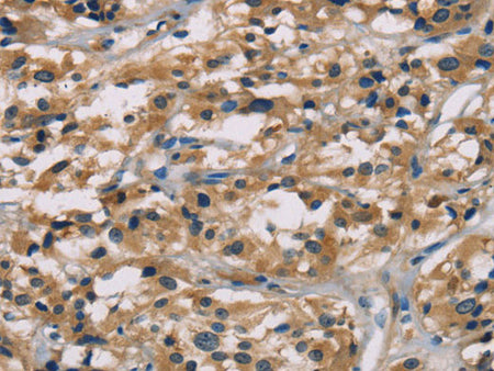 HCG Polyclonal Antibody Store at -20°C