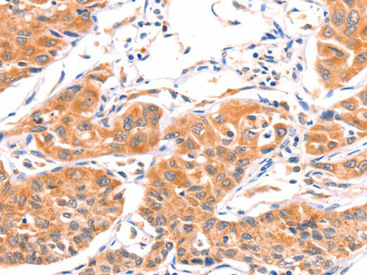 AMPD1 Polyclonal Antibody Store at -20°C