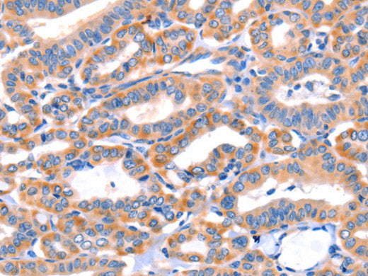 AP1B1 Polyclonal Antibody Host Rabbit