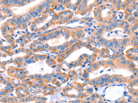 AP1B1 Polyclonal Antibody Host Rabbit