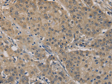 AGTRAP Polyclonal Antibody Store at -20°C