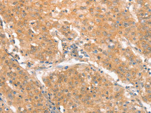 CXCR4 Polyclonal Antibody Store at -20°C
