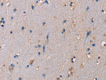 ADAM29 Polyclonal Antibody