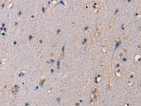 ADAM29 Polyclonal Antibody