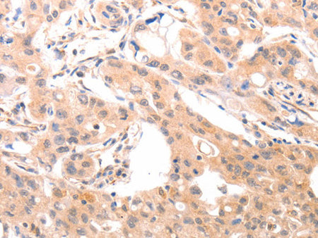 ACO1 Polyclonal Antibody Store at -20°C