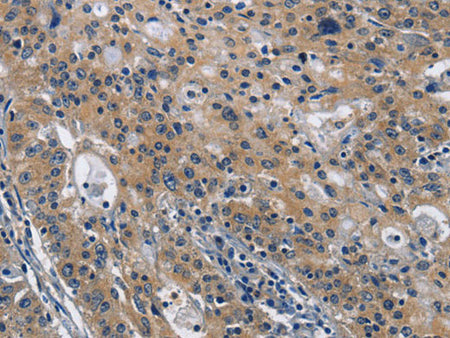 CD160 Polyclonal Antibody Store at -20°C