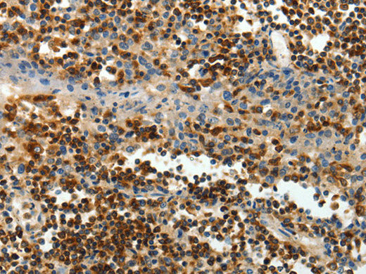 AMD1 Polyclonal Antibody Store at -20°C